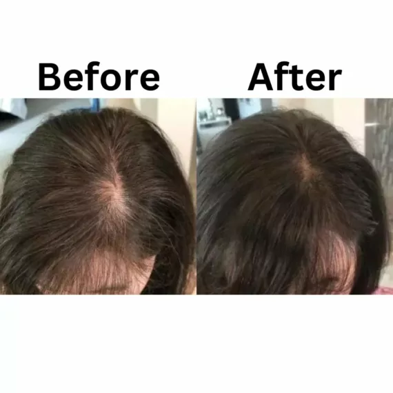 Brilixco - Hair Growth Oil