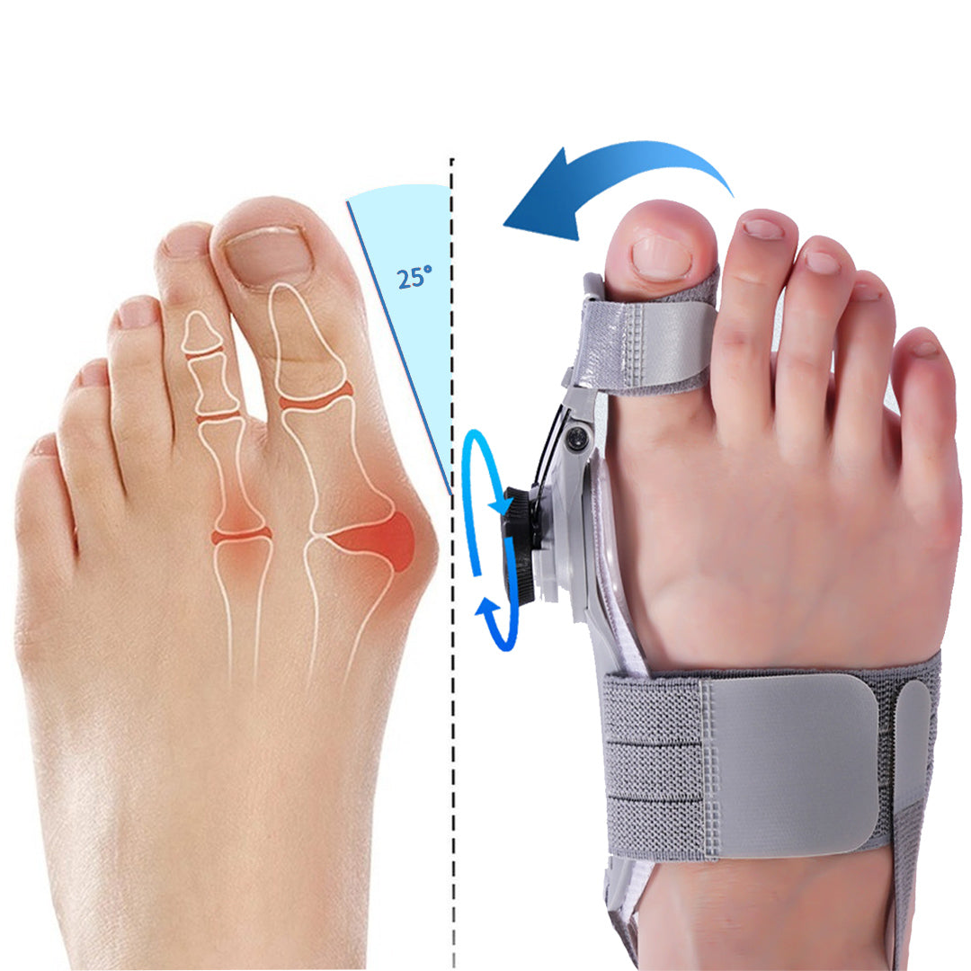 Treatmedy Bunion Fix - Natural At-Home Bunion Relief