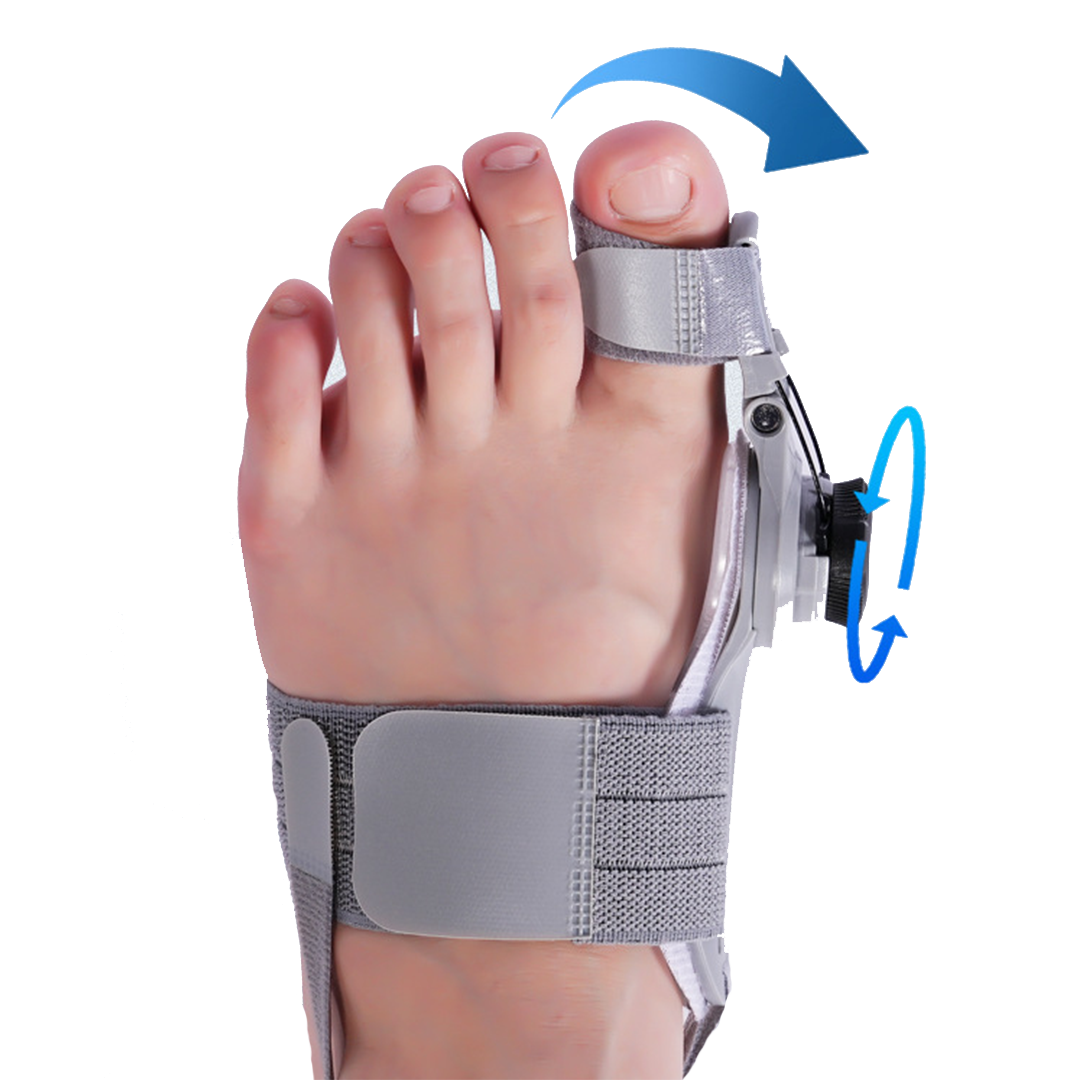 Treatmedy Bunion Fix - Natural At-Home Bunion Relief