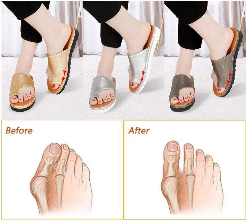 ComfyFootgear Bunion Correction Sandals