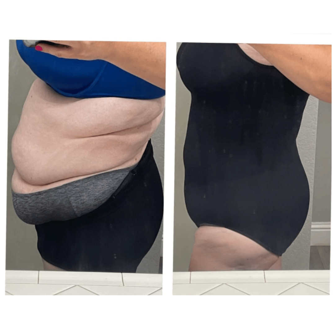 EARLY BLACK FRIDAY SALE – 50% OFF | Luxmery Bodysuit Shapewear