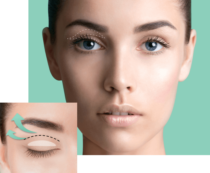 Eyelid Sticker - Lift And Revive Tired, Aged Eyes