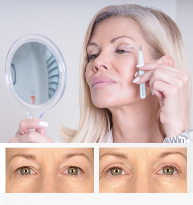 Eyelid Sticker - Lift And Revive Tired, Aged Eyes