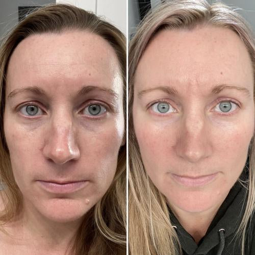 Facial Fit Pro