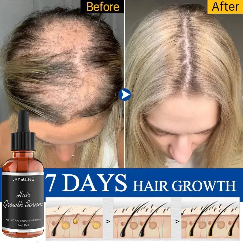 Hair Growth Serum