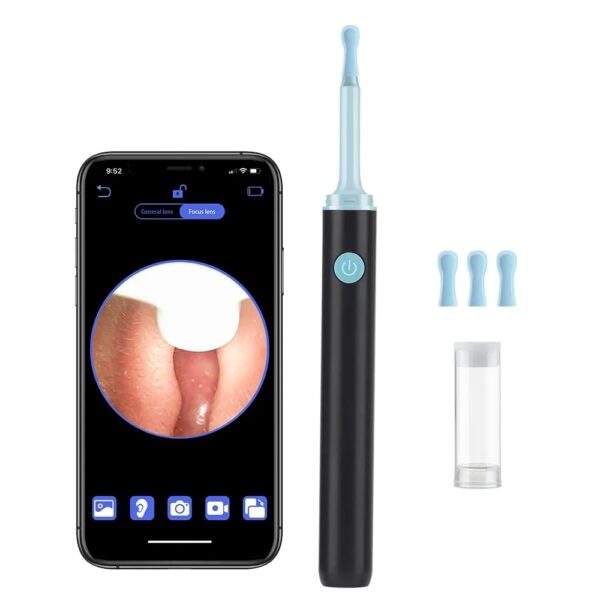 Fonenyca Ear Wax Removal Pro