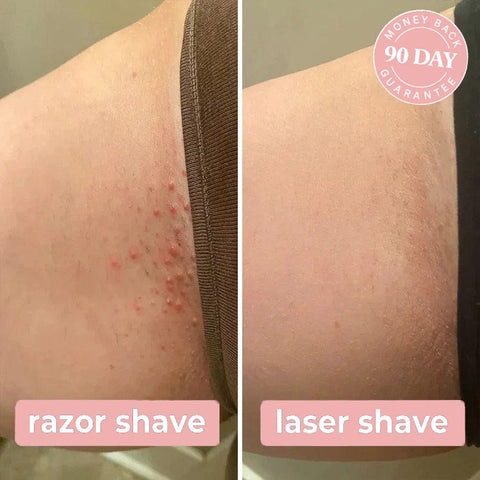 Luaper – Laser Hair Removal