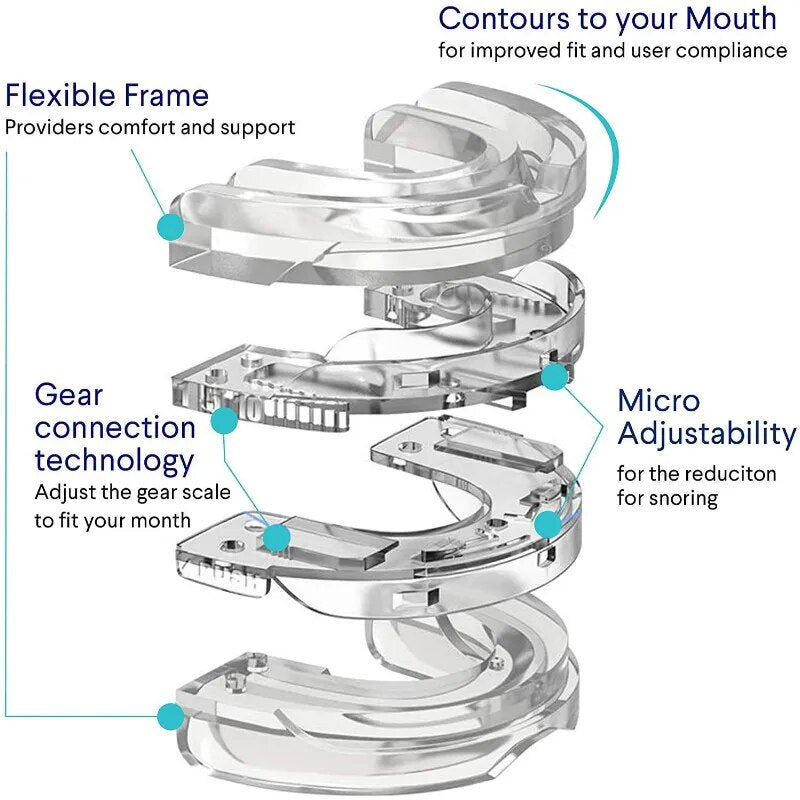 SleepEase Mouthpiece