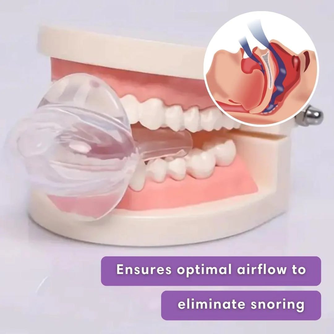 SnoozeBliss Mouthguard