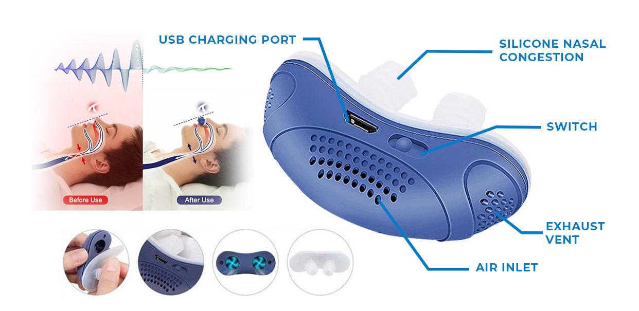 SnoreAway - Dual Turbo Vortex Anti-Snoring Solution Sleek & Rechargeable