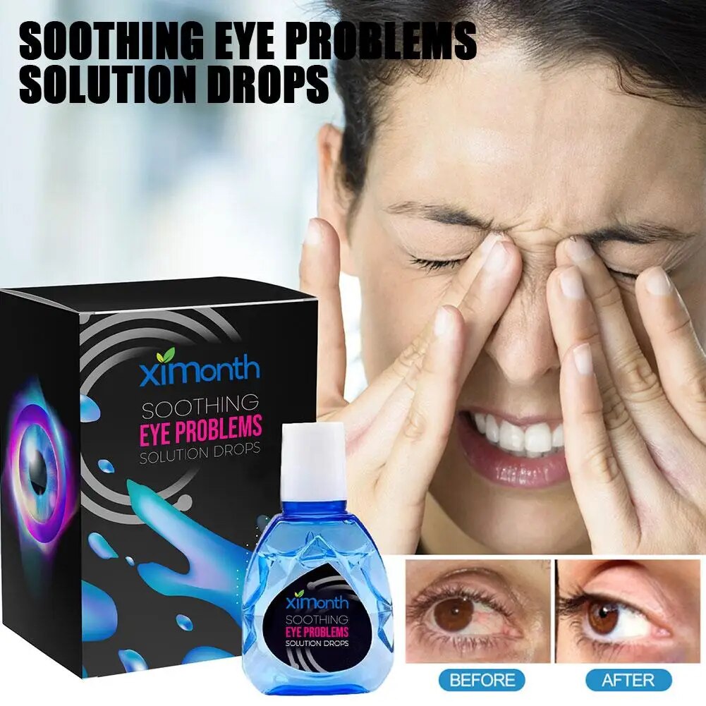 Treatment EyeProblems SolutionDrops