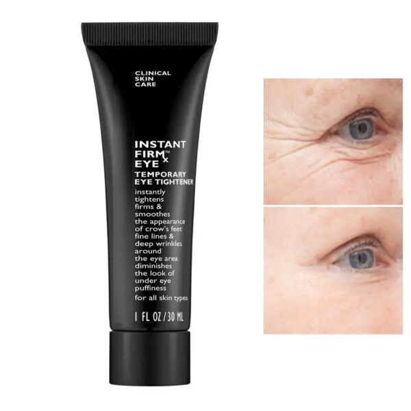 Christmas Sale - 49% OFF!! - FIRM Eye Tightener