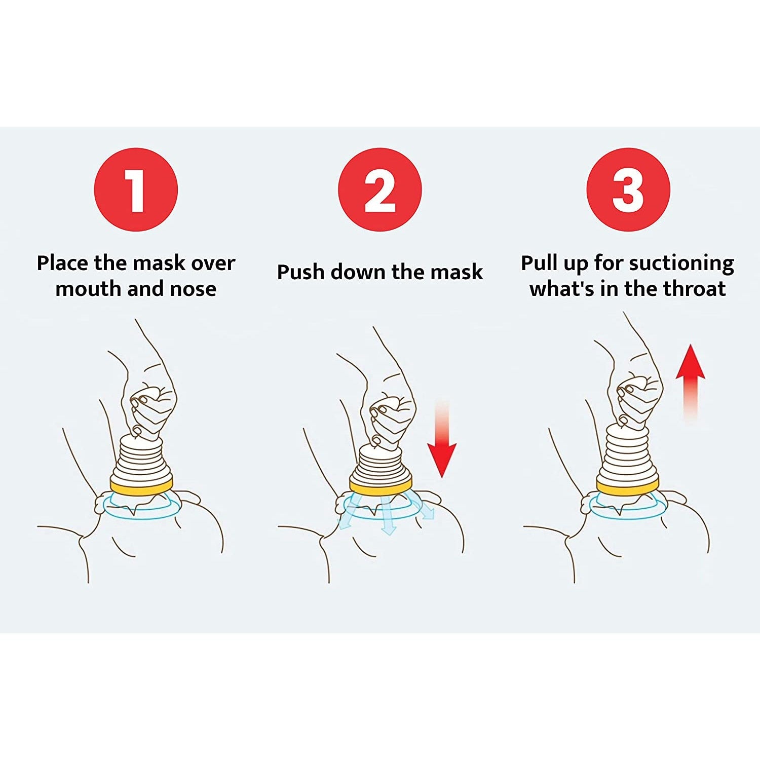 ChokeGuard Anti-Choking Kit