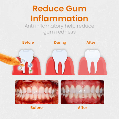 Contributioy Gum Repair Treatment Ampoules