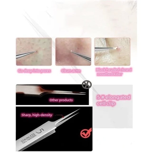 Facial Blackhead Remover Tweezers