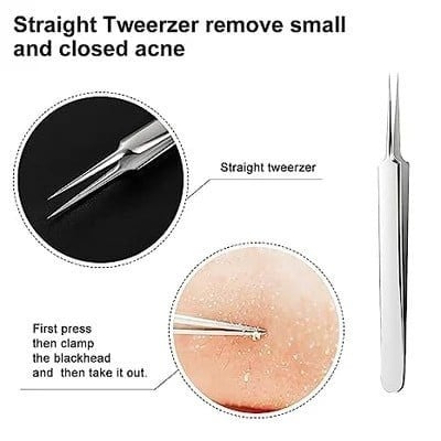 Facial Blackhead Remover Tweezers