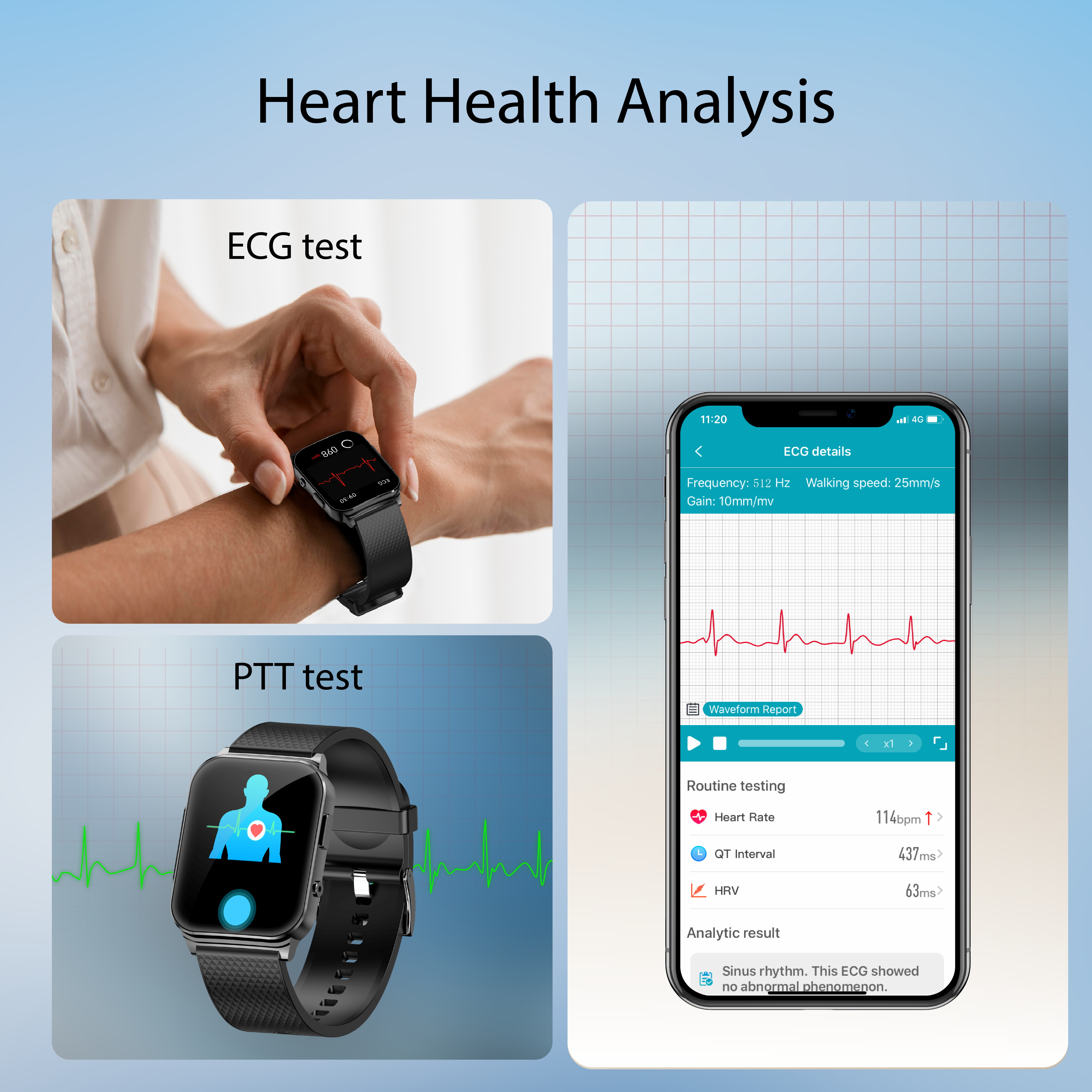 KH03 Health Smart Watch ECG/EKG Heart Rate Blood Pressure Blood Glucose Sedentary Reminder