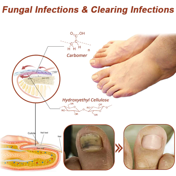 Oveallgo -  PROMAX Revolutionary High-Efficiency Light Therapy Device For Toenail Diseases