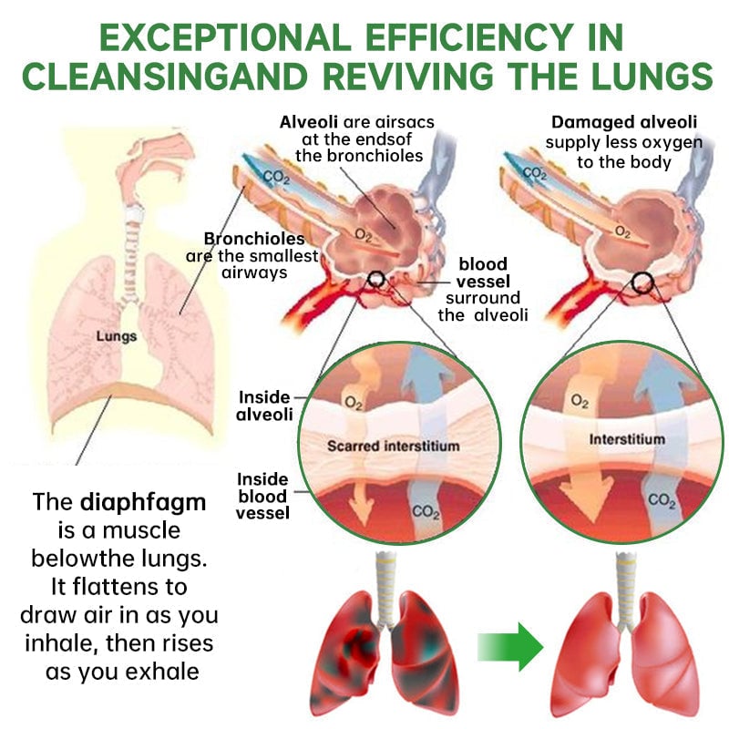 RespiClean Herbal Lung and Breath Spray