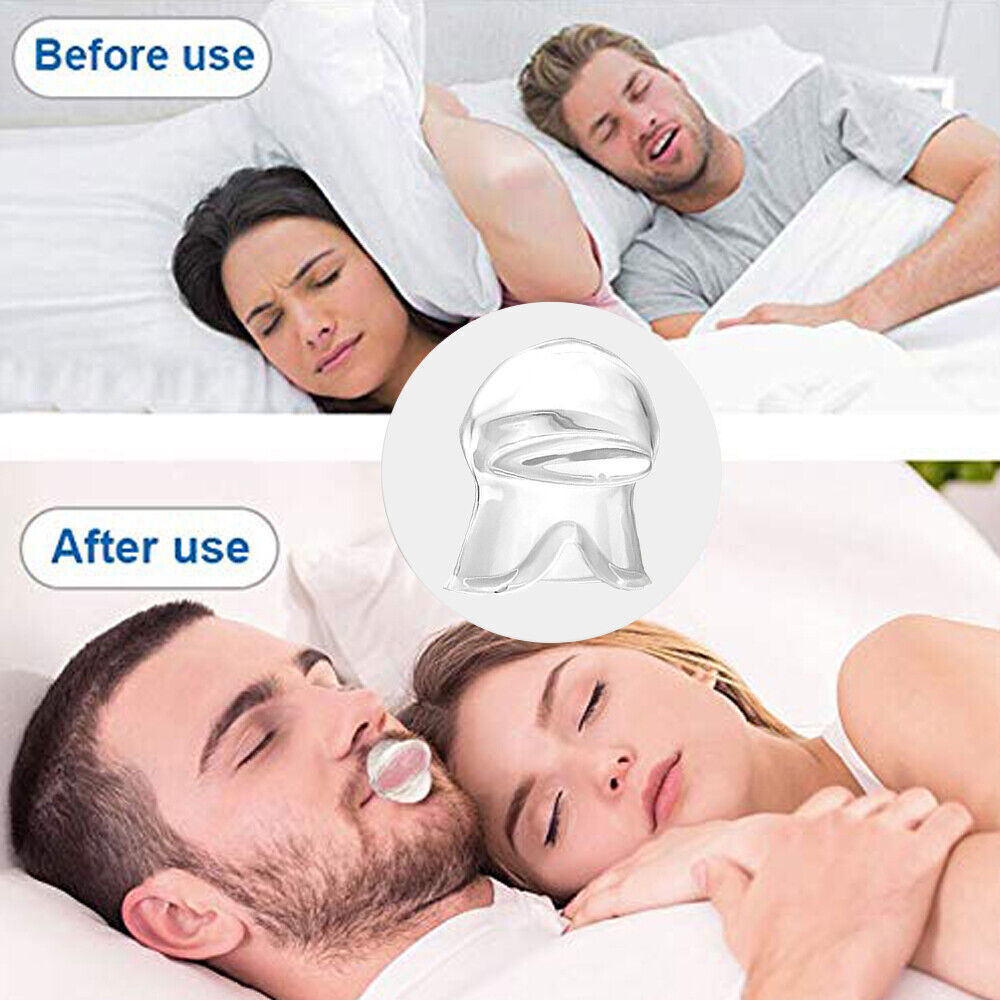 Kossoy Snore Guard