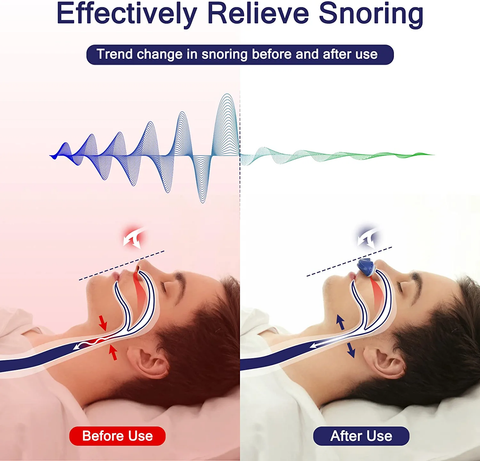 Kvrtoow 2023 The First Hoseless, Maskless, Micro-CPAP Anti Snoring