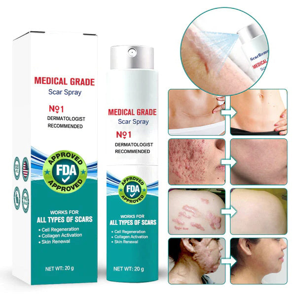 Advanced Scar Spray For All Types of Scars - For example Acne Scars, Surgical Scars and Stretch Marks 