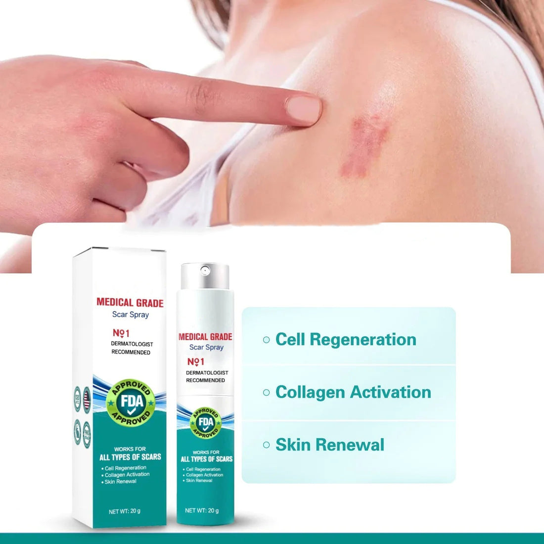 Advanced Scar Spray For All Types of Scars - For example Acne Scars, Surgical Scars and Stretch Marks 