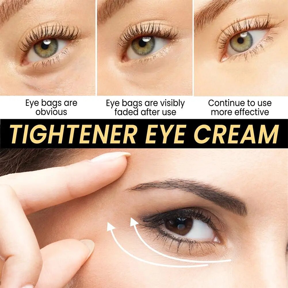 Cream for Removing Eye Bags