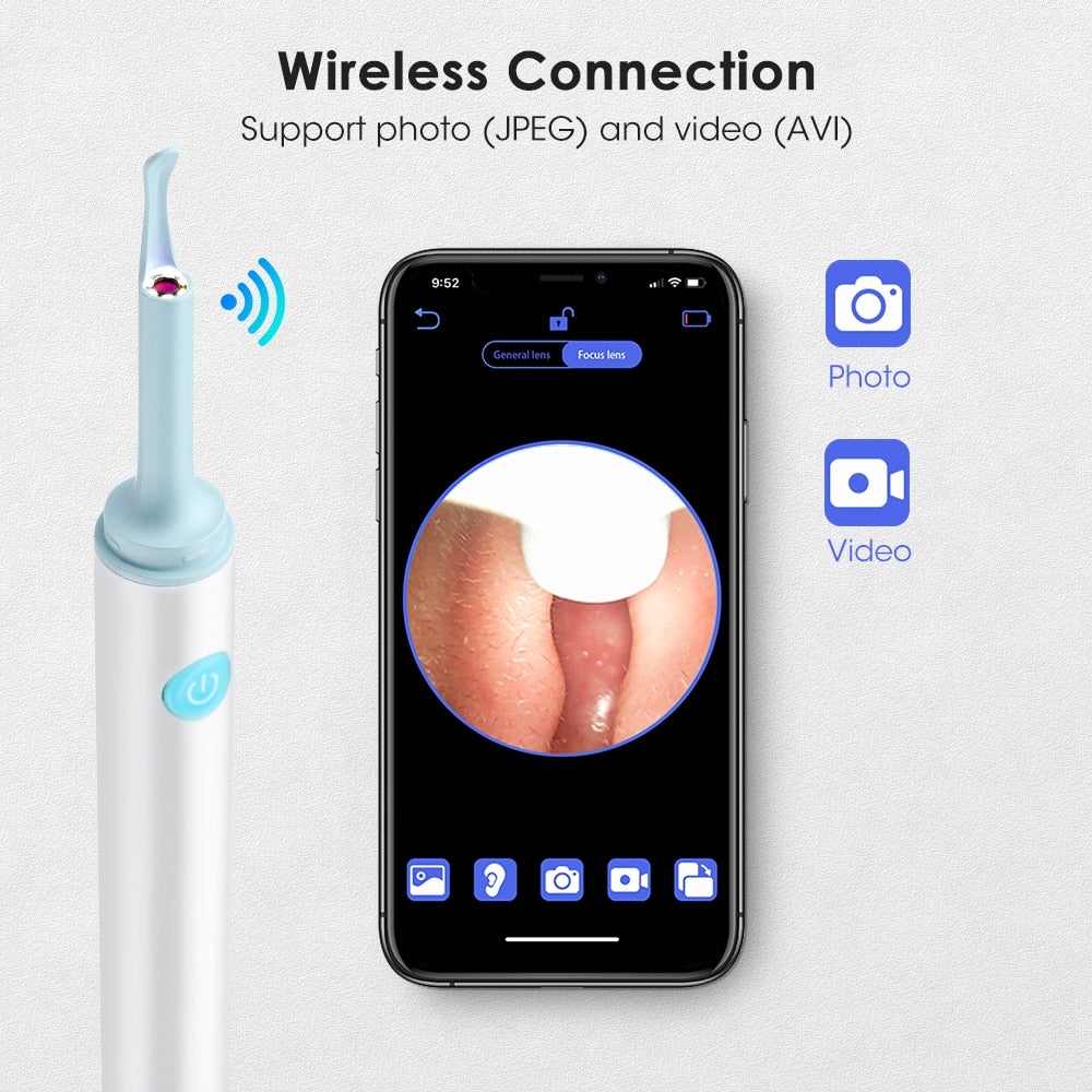 Ear Wax Removal Tool Camera