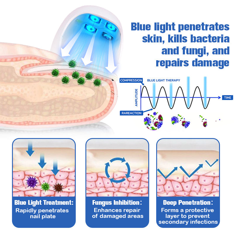 Furzero Nail Fungus Cleaning Laser Relief Device