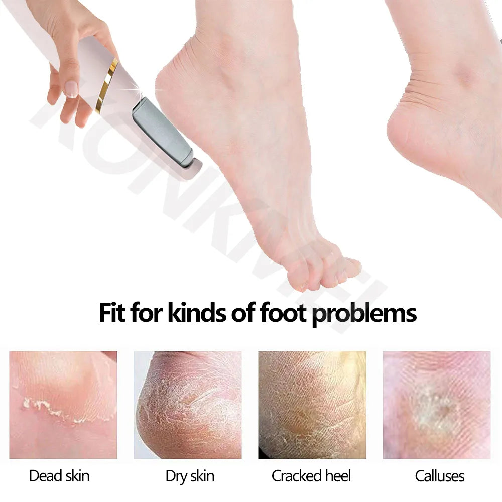 The Electric Callus Remover