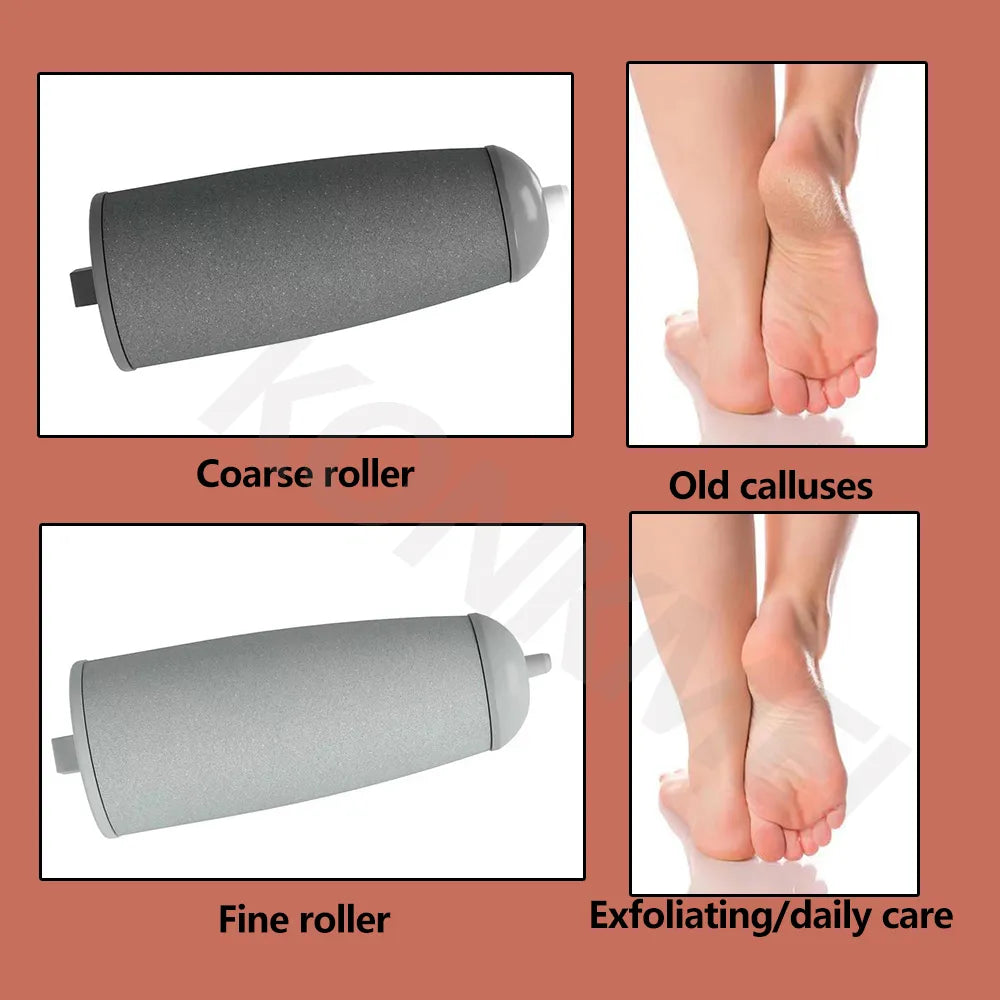 The Electric Callus Remover