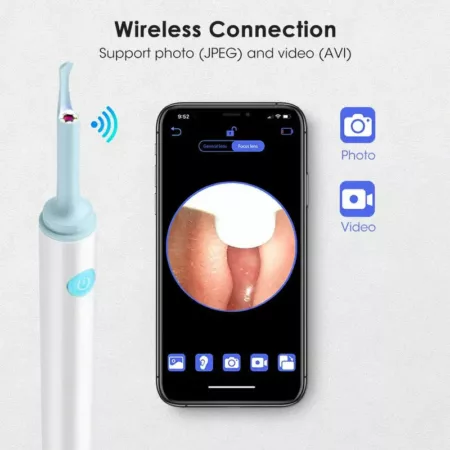 TheWaxCam - Wireless Ear Wax Removal With Camera (UP TO 70% OFF)