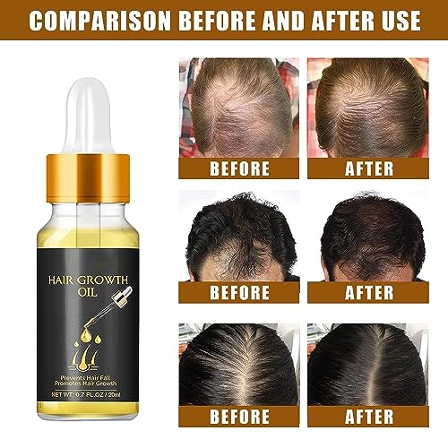 Tress Diary Hair Growth Oil