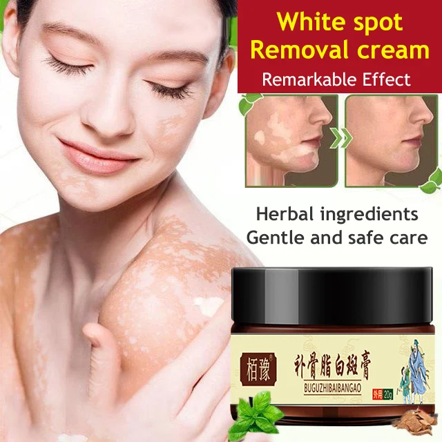 White spot removal cream