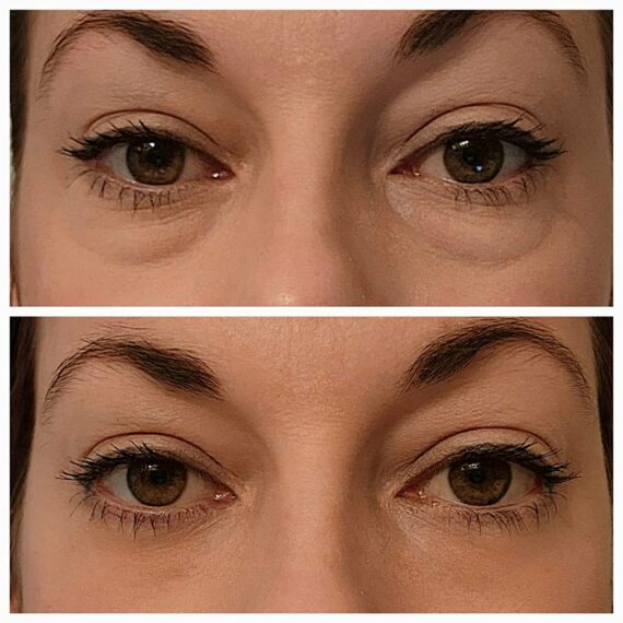 Gorgeousnetic - Instant FIRMx Eye Temporary Eye Tightener