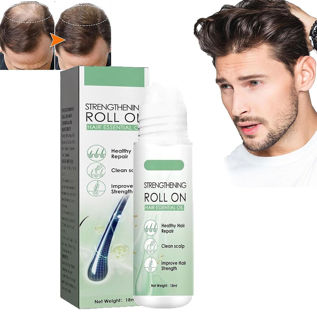 Last Day Promotion 49% OFF - Renewhair X Roller Thick Hair Essential Oil