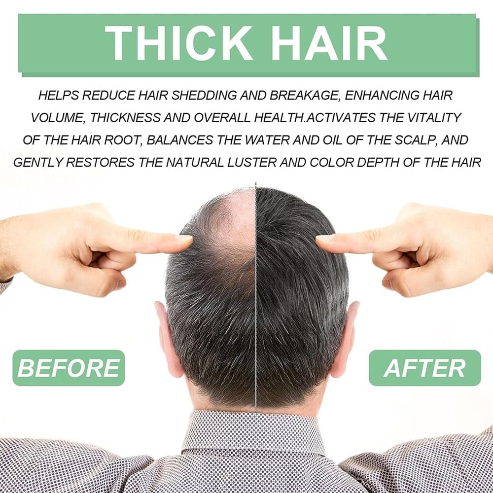 Last Day Promotion 49% OFF - Renewhair X Roller Thick Hair Essential Oil