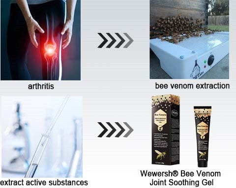 MOONBIFFY New Zealand Bee Venom Joint Relief Gel(New Zealand Bee Extract - Specializes in the treatment of orthopedic conditions and arthritic pain)