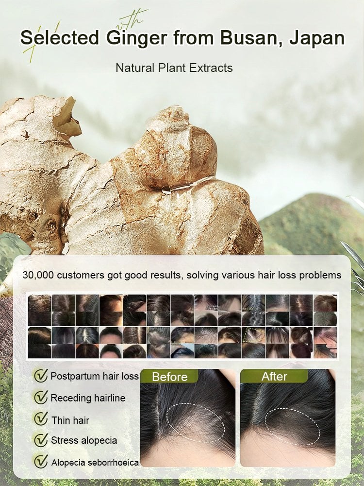 New Year Sale 49% OFF - Hot Sale Ginger Plant Extract Anti-Hair Loss Hair Shampoo