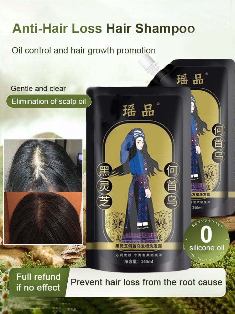 New Year Sale 49% OFF - Hot Sale Ginger Plant Extract Anti-Hair Loss Hair Shampoo