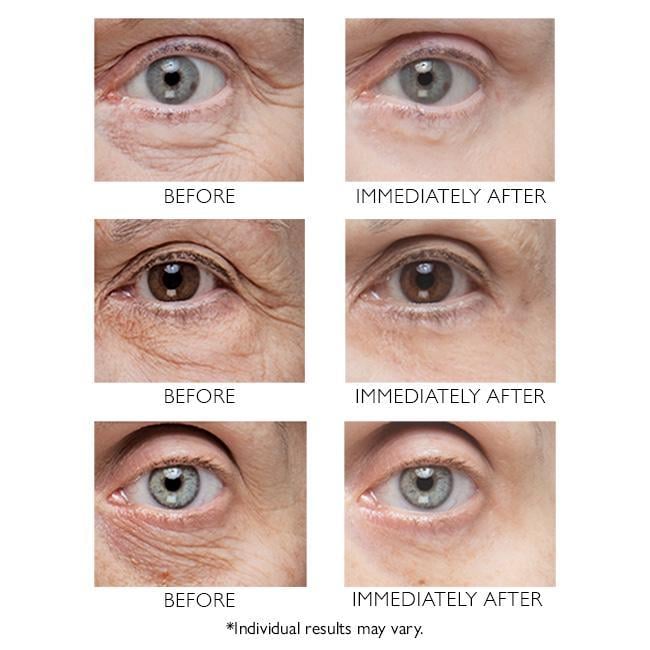 Puffless FIRM Eye Tightener