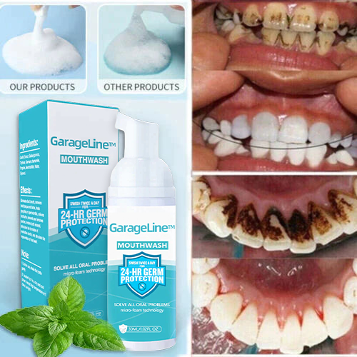 2024 brand new event GarageLine tooth mousse (For all kinds of oral problems, especially teeth regeneration)