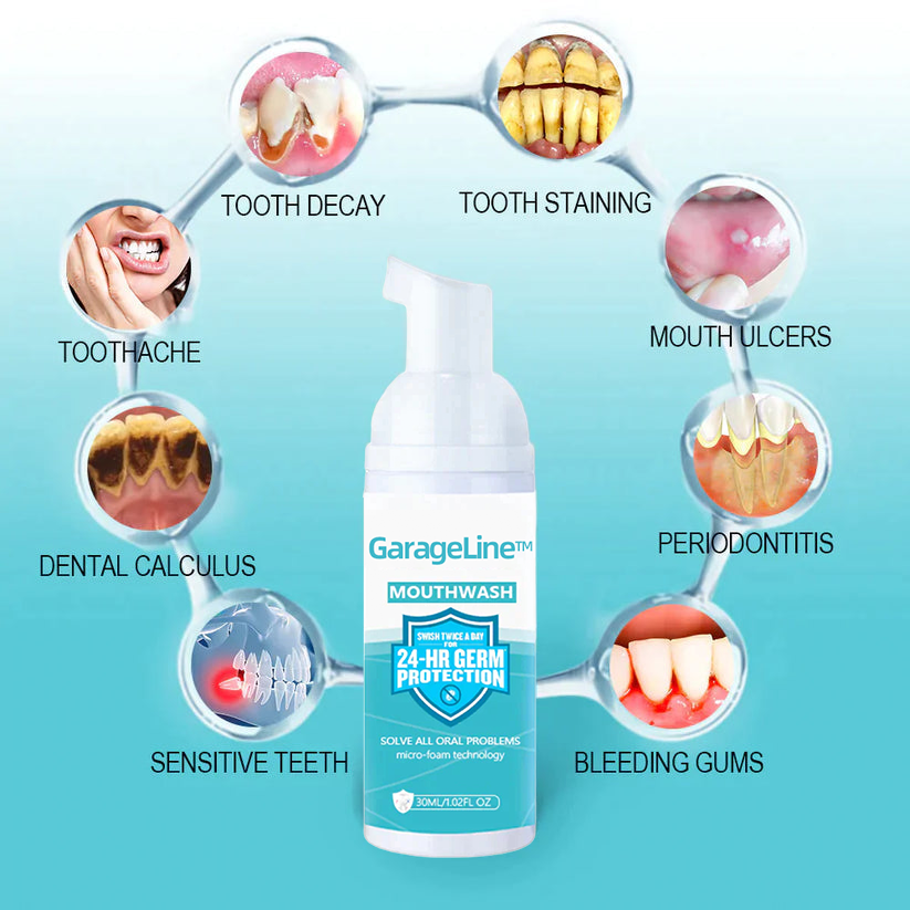 2024 brand new event GarageLine tooth mousse (For all kinds of oral problems, especially teeth regeneration)