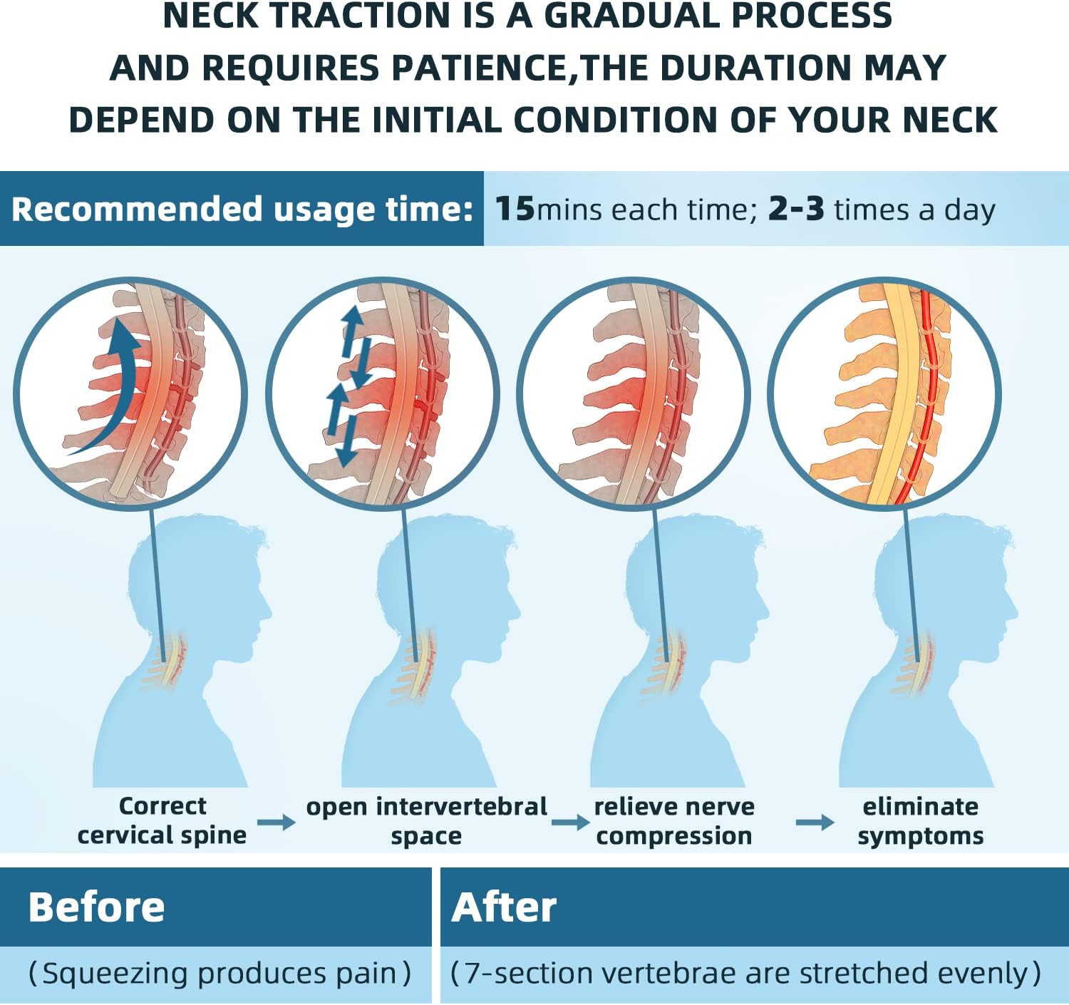 Cervictrex - Doctor Developed Neck Pain Relief Device through Cervical Spine Decompression.