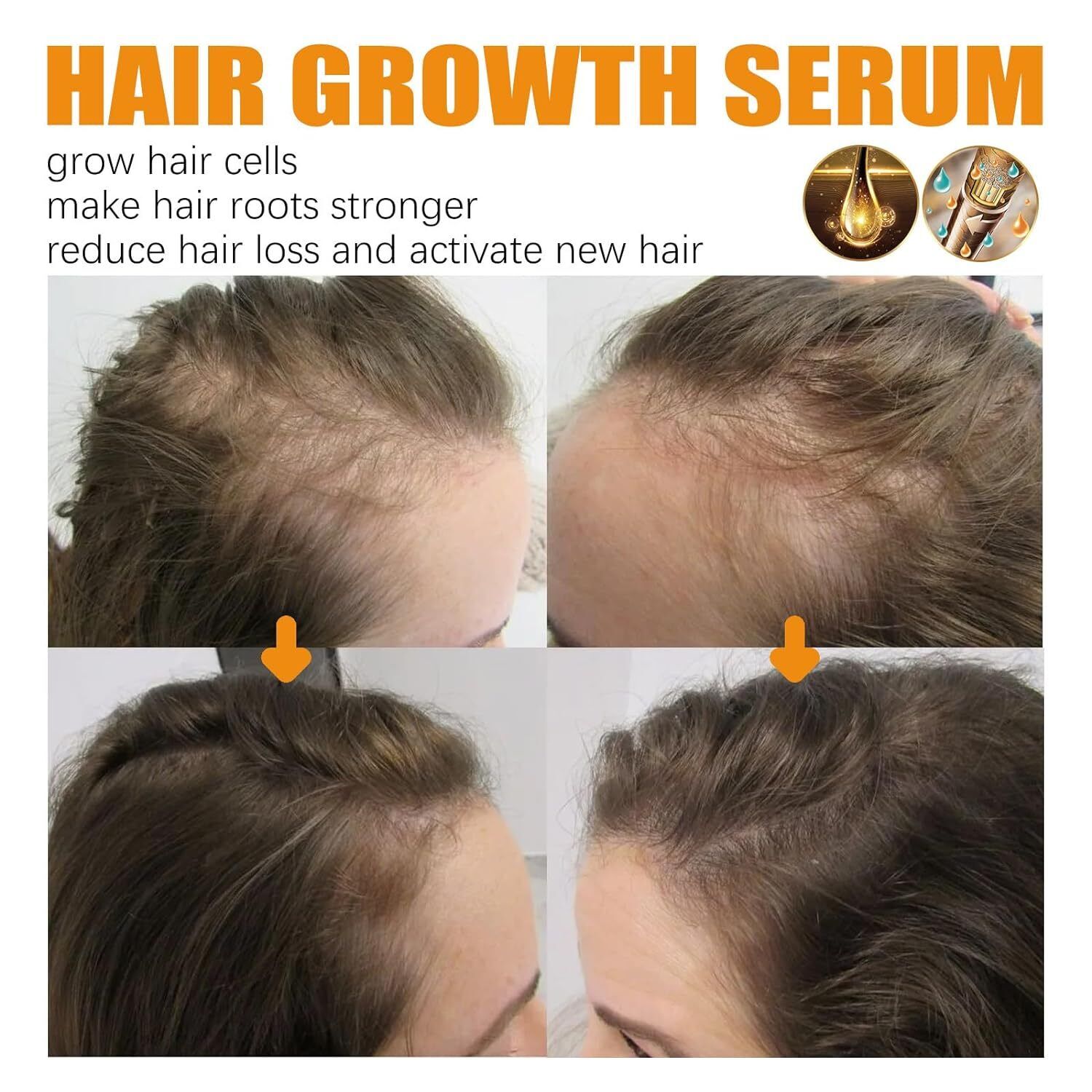 (LAST DAY SALE-80% OFF) Moonbiffy - Biotin Premium Hair Growth Serum