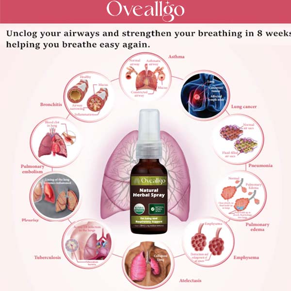 Oveallgo ProX Natural Herbal Spray for Lung and Respiratory Support