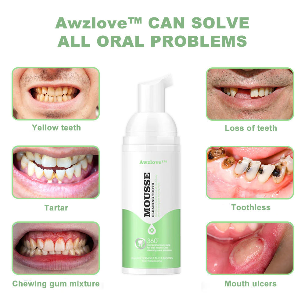 Awzlove Teeth Total Care Foaming Mouthwash - Solve all Oral Problems - Healthy Gums Solution