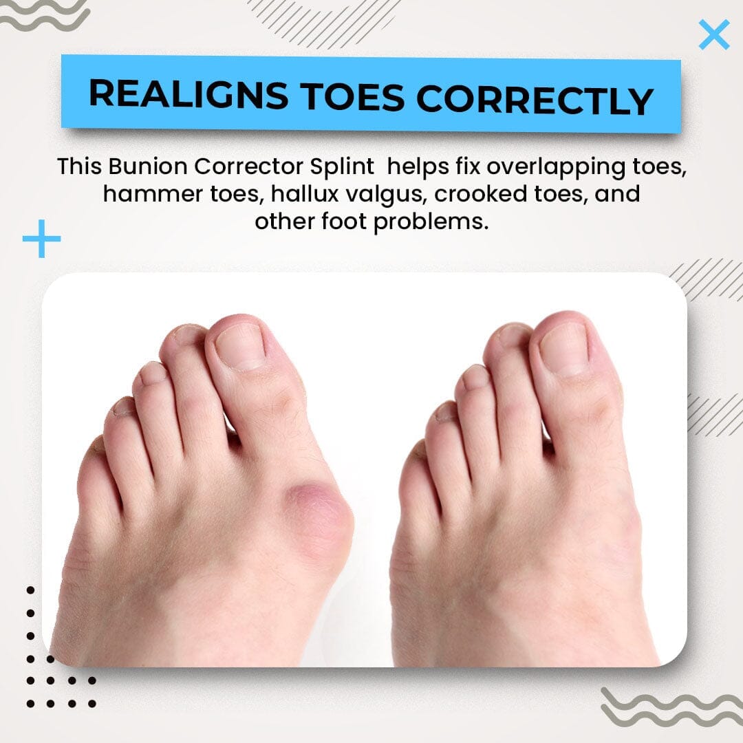 Alayna - 3D Bunion Splint Corrector