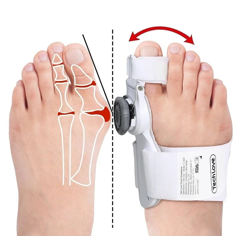 Bunaline - Bunion Corrector